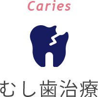 Caries むし歯治療