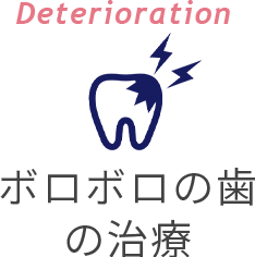Deterioration ボロボロの歯の治療